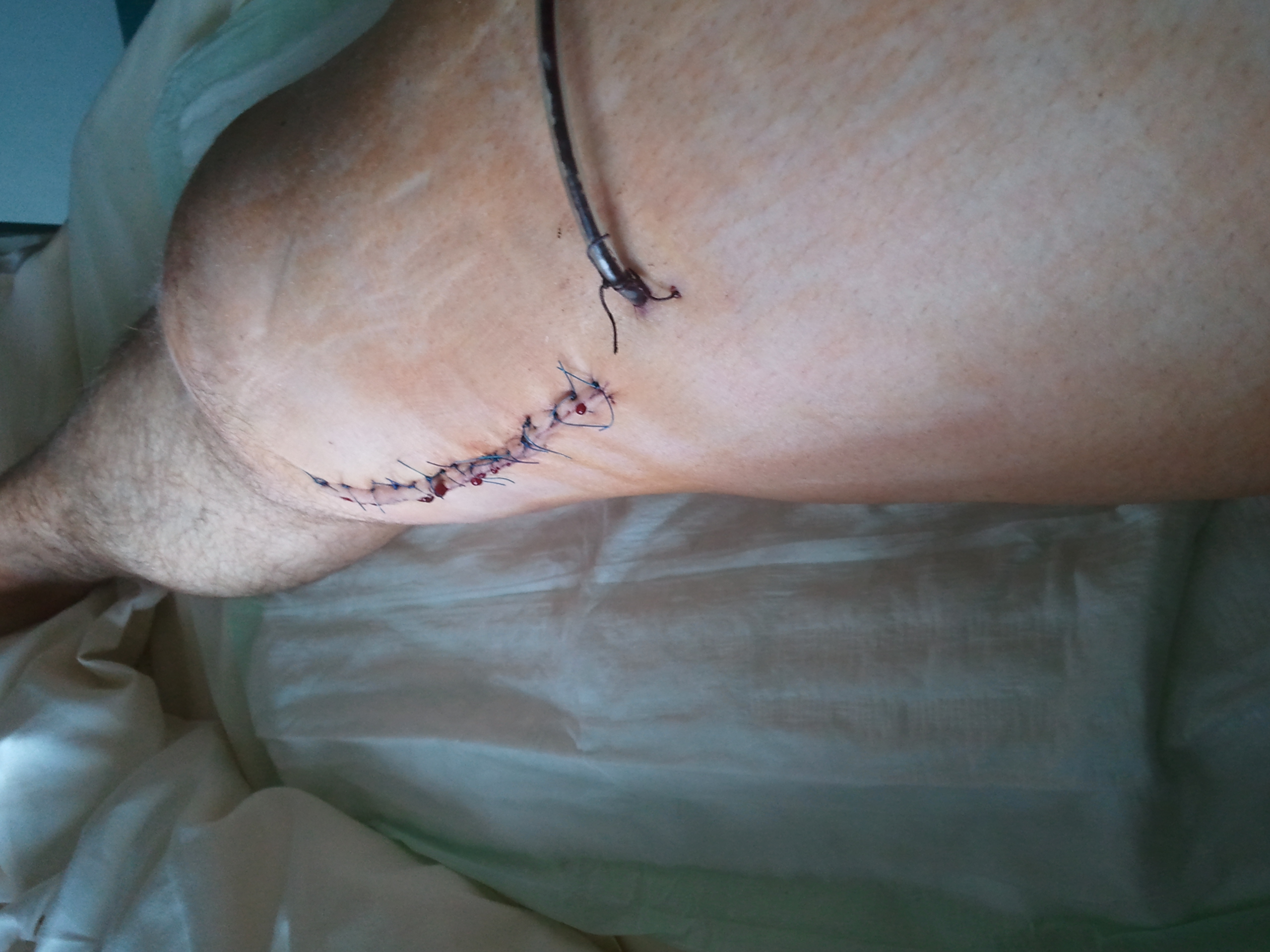 2011-04-01 12.38.30.jpg