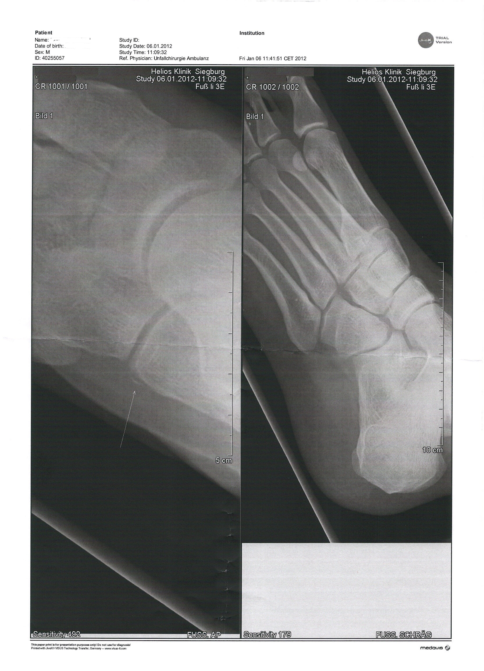 Fuss Umgeknickt Arzt Kh Diagnose Knocher Bild Fuss Verknickt
